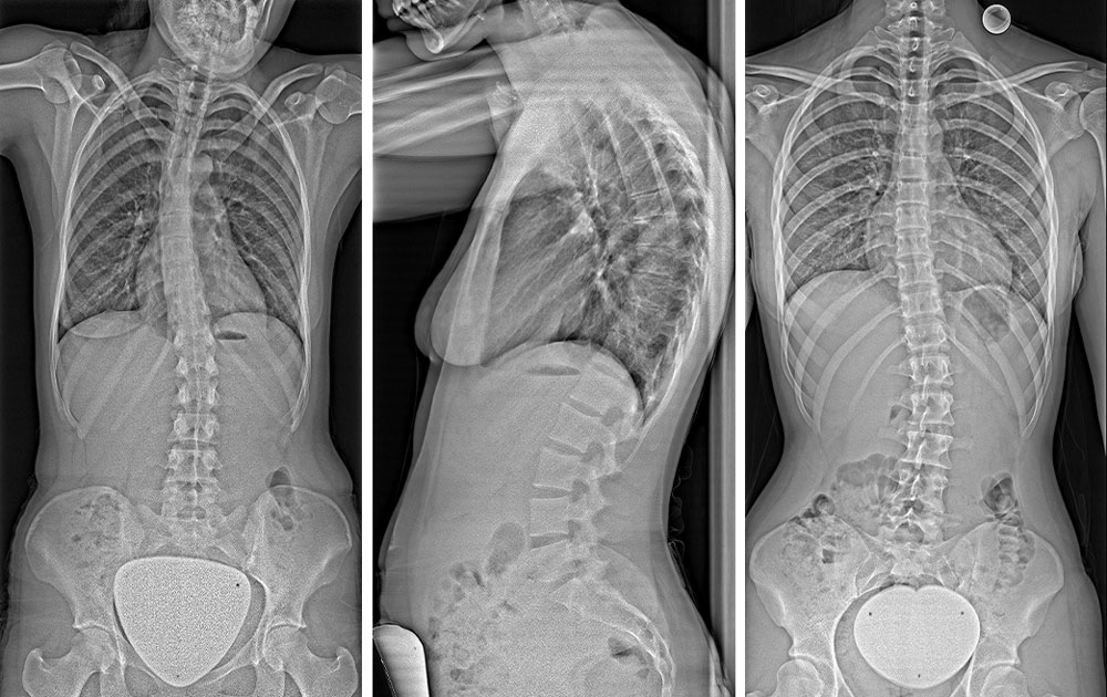 True2scale Body Scan on the Rax