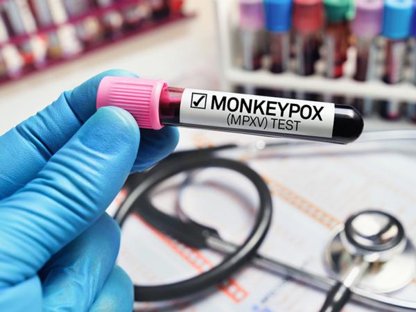 monkeypox800x600_thumb.jpg (Original)